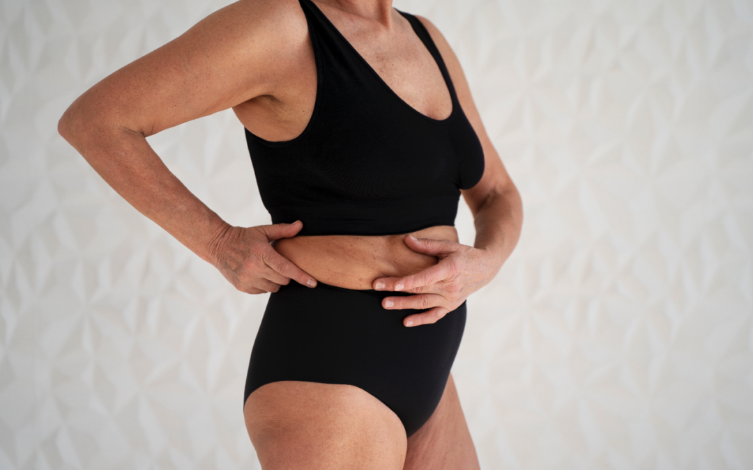 diástasis abdominal